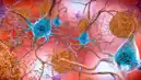Alzheimer'da Kanser İlaçlarından Umut!